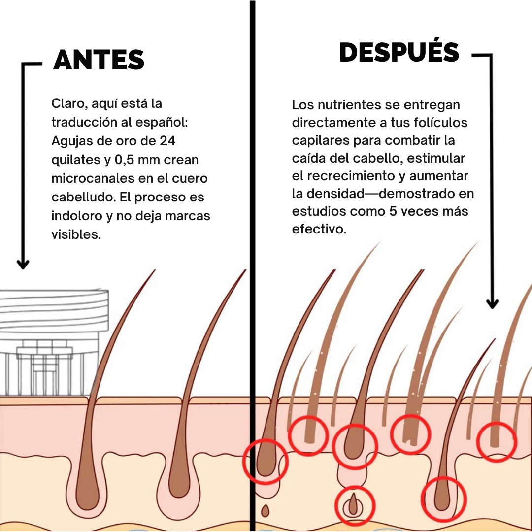 Sistema de regeneración capilar Infustrand™