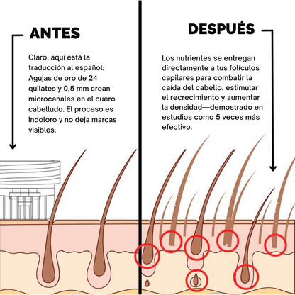 Sistema de regeneración capilar Infustrand™