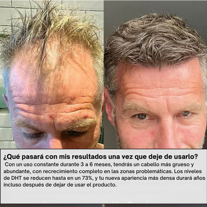 Sistema de regeneración capilar Infustrand™